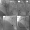 Figure 21