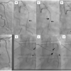 Figure 22