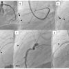 Figure 23