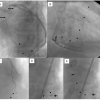 Figure 25