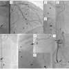 Figure 26