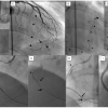 Figure 29