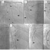 Figure 30