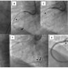 Figure 33