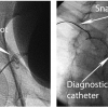 Figure 18A