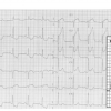 Figure 12A