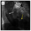 Illustrative case 4