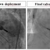 Figure 19