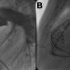 ILLUSTRATIVE CASE 1