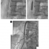 Figure 19B