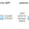 Figure 22