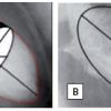 Figure 38