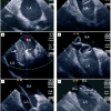 Figure 14