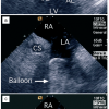 Figure 18