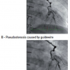 Figure 27